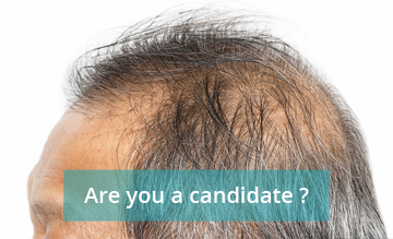 Are you a candidate ?