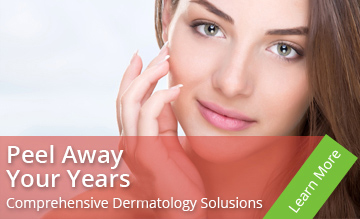 Peel away your years